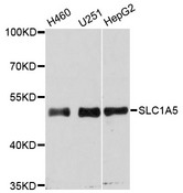 SLC1A5 / ASCT2 Antibody - Western blot analysis of extracts of various cell lines.