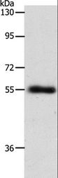 SLC1A5 / ASCT2 Antibody - Western blot analysis of Mouse lung tissue, using SLC1A5 Polyclonal Antibody at dilution of 1:600.