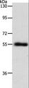 SLC1A5 / ASCT2 Antibody - Western blot analysis of Mouse lung tissue, using SLC1A5 Polyclonal Antibody at dilution of 1:600.