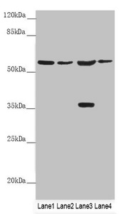 SLC1A5 / ASCT2 Antibody - Western blot All Lanes: SLC1A5 antibody at 9.89 ug/ml Lane 1: Mouse lung tissue Lane 2: Jurkat whole cell lysate Lane 3: 293T whole cell lysate Lane 4: Hela whole cell lysate Secondary Goat polyclonal to rabbit IgG at 1/10000 dilution Predicted band size: 57,37,34 kDa Observed band size: 57,37 kDa