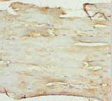 SLC1A5 / ASCT2 Antibody - Immunohistochemistry of paraffin-embedded human skeletal muscle tissue at dilution 1:100