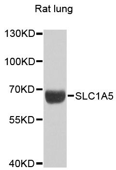 SLC1A5 / ASCT2 Antibody - Western blot analysis of extracts of rat lung, using SLC1A5 antibody at 1:1000 dilution. The secondary antibody used was an HRP Goat Anti-Rabbit IgG (H+L) at 1:10000 dilution. Lysates were loaded 25ug per lane and 3% nonfat dry milk in TBST was used for blocking. An ECL Kit was used for detection and the exposure time was 90s.