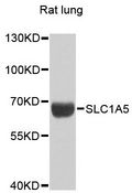 SLC1A5 / ASCT2 Antibody - Western blot analysis of extracts of rat lung, using SLC1A5 antibody at 1:1000 dilution. The secondary antibody used was an HRP Goat Anti-Rabbit IgG (H+L) at 1:10000 dilution. Lysates were loaded 25ug per lane and 3% nonfat dry milk in TBST was used for blocking. An ECL Kit was used for detection and the exposure time was 90s.