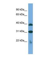 SLC1A6 / EAAT4 Antibody - Western blot of Human Jurkat. SLC1A6 antibody dilution 1.0 ug/ml.  This image was taken for the unconjugated form of this product. Other forms have not been tested.