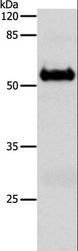 SLC1A6 / EAAT4 Antibody - Western blot analysis of Mouse brain tissue, using SLC1A6 Polyclonal Antibody at dilution of 1:600.