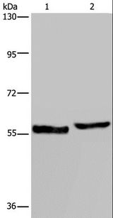 SLC1A6 / EAAT4 Antibody - Western blot analysis of Human testis tissue and A375 cell, using SLC1A6 Polyclonal Antibody at dilution of 1:400.