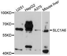 SLC1A6 / EAAT4 Antibody - Western blot analysis of extracts of various cells.