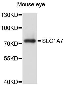 SLC1A7 / EAAT5 Antibody - Western blot analysis of extracts of mouse eye, using SLC1A7 antibody at 1:1000 dilution. The secondary antibody used was an HRP Goat Anti-Rabbit IgG (H+L) at 1:10000 dilution. Lysates were loaded 25ug per lane and 3% nonfat dry milk in TBST was used for blocking. An ECL Kit was used for detection and the exposure time was 30s.