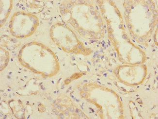 SLC1A7 / EAAT5 Antibody - Immunohistochemistry of paraffin-embedded human kidney tissue at dilution 1:100