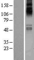 SLC1A7 / EAAT5 Protein - Western validation with an anti-DDK antibody * L: Control HEK293 lysate R: Over-expression lysate