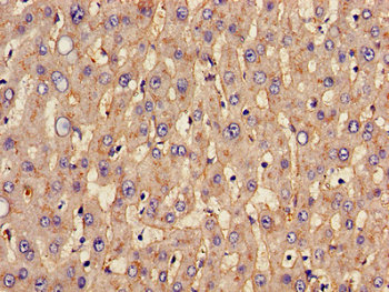 SLC20A1 Antibody - Immunohistochemistry image of paraffin-embedded human liver tissue at a dilution of 1:100