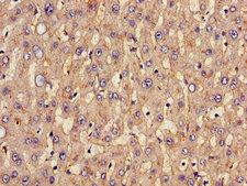 SLC20A1 Antibody - Immunohistochemistry image of paraffin-embedded human liver tissue at a dilution of 1:100