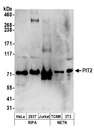 SLC20A2 / PIT2 Antibody - Detection of human and mouse PIT2 by western blot. Samples: Whole cell lysate (50 µg) from HeLa, HEK293T, Jurkat, mouse TCMK-1, and mouse NIH 3T3 cells prepared using NETN and RIPA lysis buffer. Antibodies: Affinity purified rabbit anti-PIT2 antibody used for WB at 0.1 µg/ml. Detection: Chemiluminescence with an exposure time of 3 minutes.