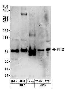 SLC20A2 / PIT2 Antibody - Detection of human and mouse PIT2 by western blot. Samples: Whole cell lysate (50 µg) from HeLa, HEK293T, Jurkat, mouse TCMK-1, and mouse NIH 3T3 cells prepared using NETN and RIPA lysis buffer. Antibodies: Affinity purified rabbit anti-PIT2 antibody used for WB at 0.1 µg/ml. Detection: Chemiluminescence with an exposure time of 3 minutes.