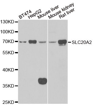 SLC20A2 / PIT2 Antibody - Western blot analysis of extracts of various cell lines.