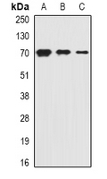 SLC20A2 / PIT2 Antibody - Western blot analysis of PiT2 expression in HepG2 (A); mouse kidney (B); rat liver (C) whole cell lysates.