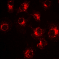 SLC20A2 / PIT2 Antibody - Immunofluorescent analysis of PiT2 staining in HeLa cells. Formalin-fixed cells were permeabilized with 0.1% Triton X-100 in TBS for 5-10 minutes and blocked with 3% BSA-PBS for 30 minutes at room temperature. Cells were probed with the primary antibody in 3% BSA-PBS and incubated overnight at 4 deg C in a humidified chamber. Cells were washed with PBST and incubated with a DyLight 594-conjugated secondary antibody (red) in PBS at room temperature in the dark.