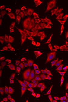 SLC20A2 / PIT2 Antibody - Immunofluorescence analysis of HeLa cells using SLC20A2 Polyclonal Antibody.
