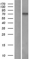 SLC20A2 / PIT2 Protein - Western validation with an anti-DDK antibody * L: Control HEK293 lysate R: Over-expression lysate
