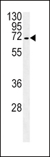 SLC22A1 Antibody - SLC22A1 Antibody western blot of HepG2 cell line lysates (35 ug/lane). The SLC22A1 antibody detected the SLC22A1 protein (arrow).