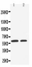 SLC22A1 Antibody - WB of SLC22A1 / OCT1 antibody. Lane 1: HELA Cell Lysate. Lane 2: A549 Cell Lysate.
