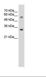 SLC22A1 Antibody - HepG2 Cell Lysate.  This image was taken for the unconjugated form of this product. Other forms have not been tested.