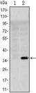 SLC22A1 Antibody - SLC22A1 Antibody in Western Blot (WB)