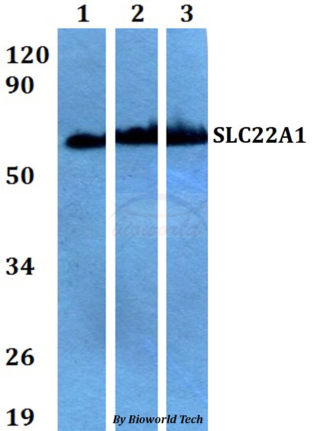 SLC22A1 Antibody - Western blot of SLC22A1 antibody at 1:500 dilution. Lane 1: A549 whole cell lysate. Lane 2: sp2/0 whole cell lysate. Lane 3: H9C2 whole cell lysate.