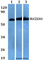 SLC22A1 Antibody - Western blot of SLC22A1 antibody at 1:500 dilution. Lane 1: A549 whole cell lysate. Lane 2: sp2/0 whole cell lysate. Lane 3: H9C2 whole cell lysate.
