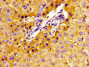 SLC22A1 Antibody - Immunohistochemistry image of paraffin-embedded human liver tissue at a dilution of 1:100