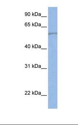 SLC22A11 Antibody - Fetal liver lysate. Antibody concentration: 1.0 ug/ml. Gel concentration: 12%.  This image was taken for the unconjugated form of this product. Other forms have not been tested.