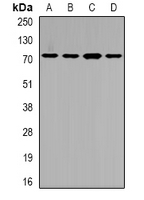 SLC22A11 Antibody - Western blot analysis of SLC22A11 expression in SW620 (A); HepG2 (B); mouse liver (C); rat kidney (D) whole cell lysates.