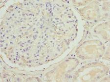 SLC22A11 Antibody - Immunohistochemistry of paraffin-embedded human kidney tissue at dilution 1:100