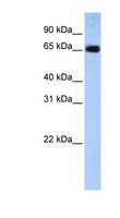 SLC22A13 Antibody - SLC22A13 antibody Western blot of Placenta lysate. This image was taken for the unconjugated form of this product. Other forms have not been tested.