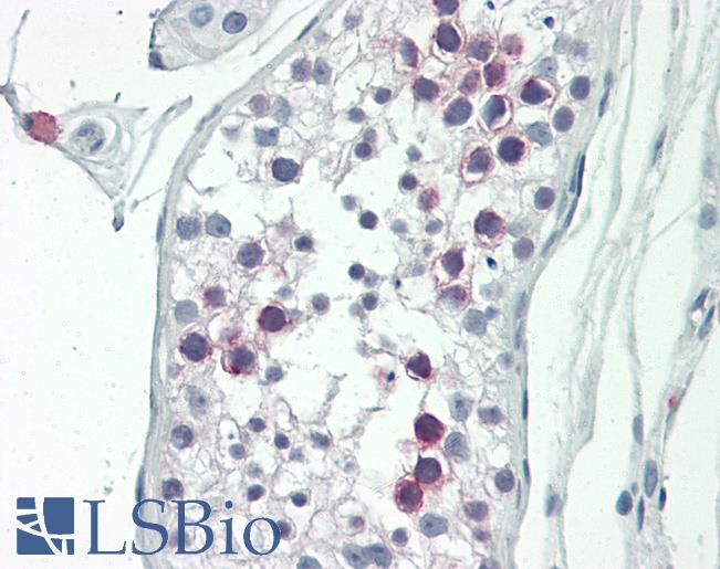 SLC22A16 Antibody - Anti-SLC22A16 antibody IHC staining of human testis. Immunohistochemistry of formalin-fixed, paraffin-embedded tissue after heat-induced antigen retrieval.  This image was taken for the unconjugated form of this product. Other forms have not been tested.