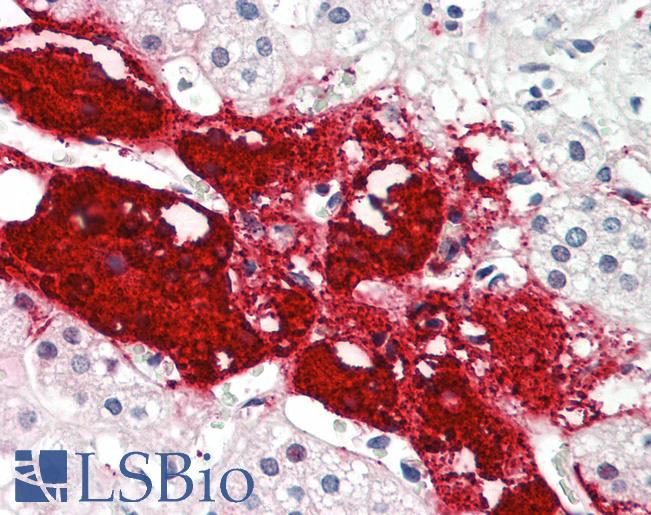 SLC22A16 Antibody - Anti-SLC22A16 antibody IHC staining of human adrenal. Immunohistochemistry of formalin-fixed, paraffin-embedded tissue after heat-induced antigen retrieval. Antibody concentration 10 ug/ml.  This image was taken for the unconjugated form of this product. Other forms have not been tested.