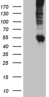 SLC22A17 Antibody - HEK293T cells were transfected with the pCMV6-ENTRY control. (Left lane) or pCMV6-ENTRY SLC22A17. (Right lane) cDNA for 48 hrs and lysed. Equivalent amounts of cell lysates. (5 ug per lane) were separated by SDS-PAGE and immunoblotted with anti-SLC22A17. (1:500)