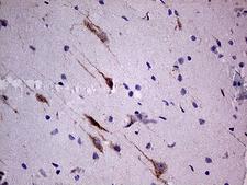 SLC22A17 Antibody - Immunohistochemical staining of paraffin-embedded Human adult brain tissue within the normal limits using anti-SLC22A17 mouse monoclonal antibody. (Heat-induced epitope retrieval by 1mM EDTA in 10mM Tris buffer. (pH8.5) at 120°C for 3 min. (1:500)