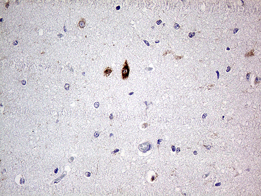 SLC22A17 Antibody - Immunohistochemical staining of paraffin-embedded Human embryonic brain cortex tissue within the normal limits using anti-SLC22A17 mouse monoclonal antibody. (Heat-induced epitope retrieval by 1mM EDTA in 10mM Tris buffer. (pH8.5) at 120 oC for 3 min. (1:500)
