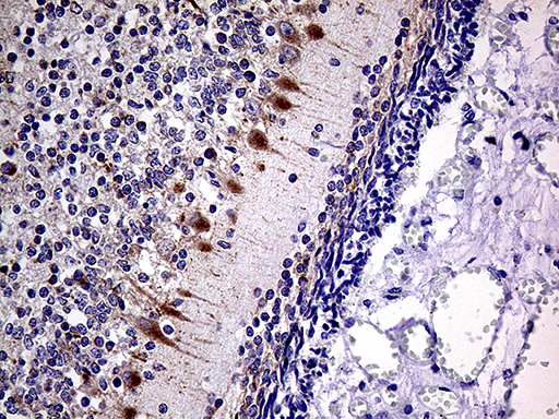 SLC22A17 Antibody - Immunohistochemical staining of paraffin-embedded Human embryonic cerebellum within the normal limits using anti-SLC22A17 mouse monoclonal antibody. (Heat-induced epitope retrieval by 1mM EDTA in 10mM Tris buffer. (pH8.5) at 120 oC for 3 min. (1:500)