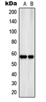 SLC22A17 Antibody - Western blot analysis of SLC22A17 expression in SKNSH (A); rat kidney (B) whole cell lysates.