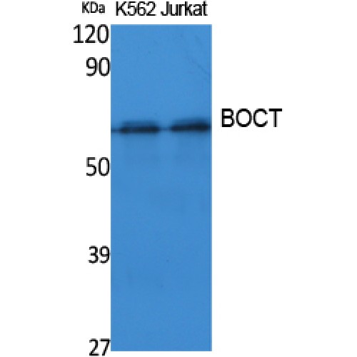 SLC22A17 Antibody - Western blot of BOCT antibody