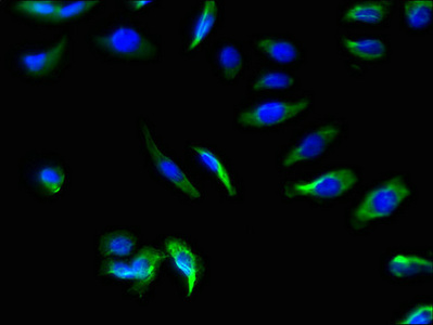 SLC22A17 Antibody - Immunofluorescent analysis of A549 cells using SLC22A17 Antibody at dilution of 1:100 and Alexa Fluor 488-congugated AffiniPure Goat Anti-Rabbit IgG(H+L)