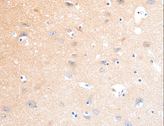 SLC22A17 Antibody - Immunohistochemistry of paraffin-embedded Human brain using SLC22A17 Polyclonal Antibody at dilution of 1:40.