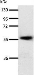 SLC22A17 Antibody - Western blot analysis of Human esophagus cancer tissue, using SLC22A17 Polyclonal Antibody at dilution of 1:600.