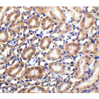 SLC22A17 Antibody - Immunohistochemistry of SLC22A17 in mouse kidney tissue with SLC22A17 antibody at 2.5 µg/ml.