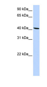 SLC22A18 Antibody - SLC22A18 antibody Western blot of HepG2 cell lysate. This image was taken for the unconjugated form of this product. Other forms have not been tested.