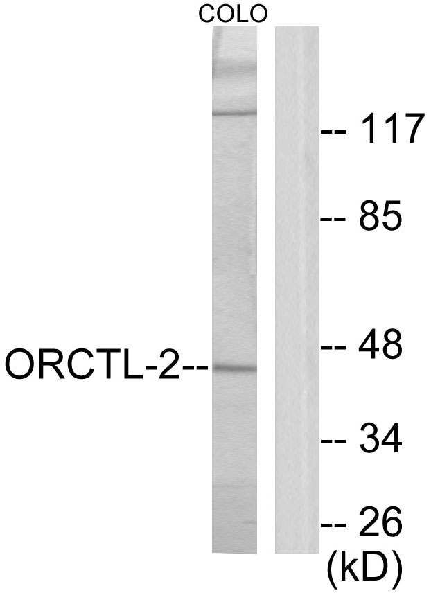SLC22A18 Antibody - Western blot analysis of lysates from COLO205 cells, using ORCTL-2 Antibody. The lane on the right is blocked with the synthesized peptide.