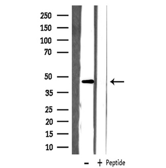 SLC22A18 Antibody - Western blot analysis of extracts of COLO205 cells using ORCTL-2 antibody.
