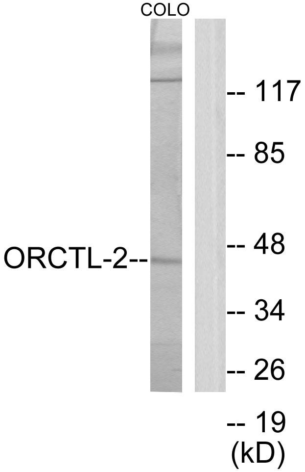 SLC22A18 Antibody - Western blot analysis of extracts from COLO205 cells, using ORCTL-2 antibody.